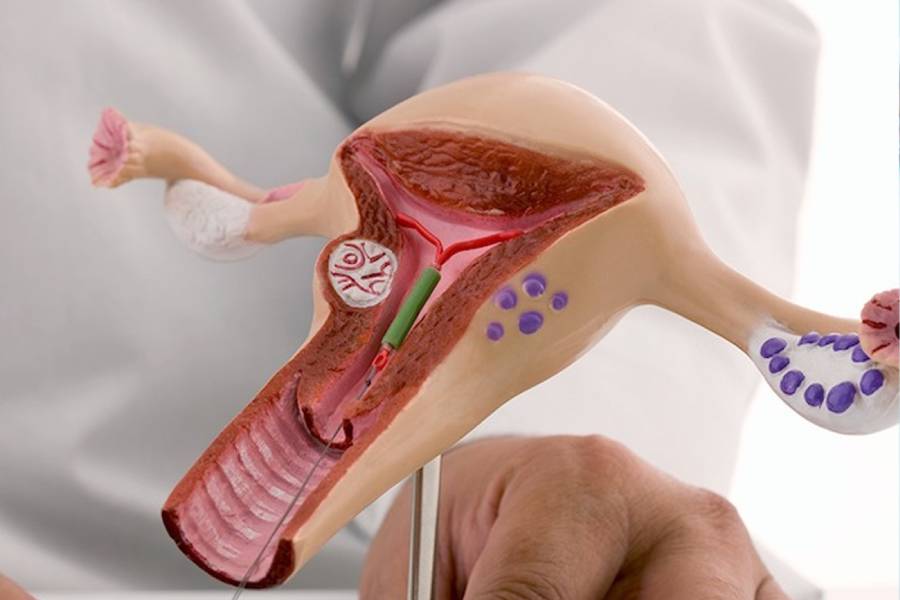Best IUI Treatment Centre in Rewari